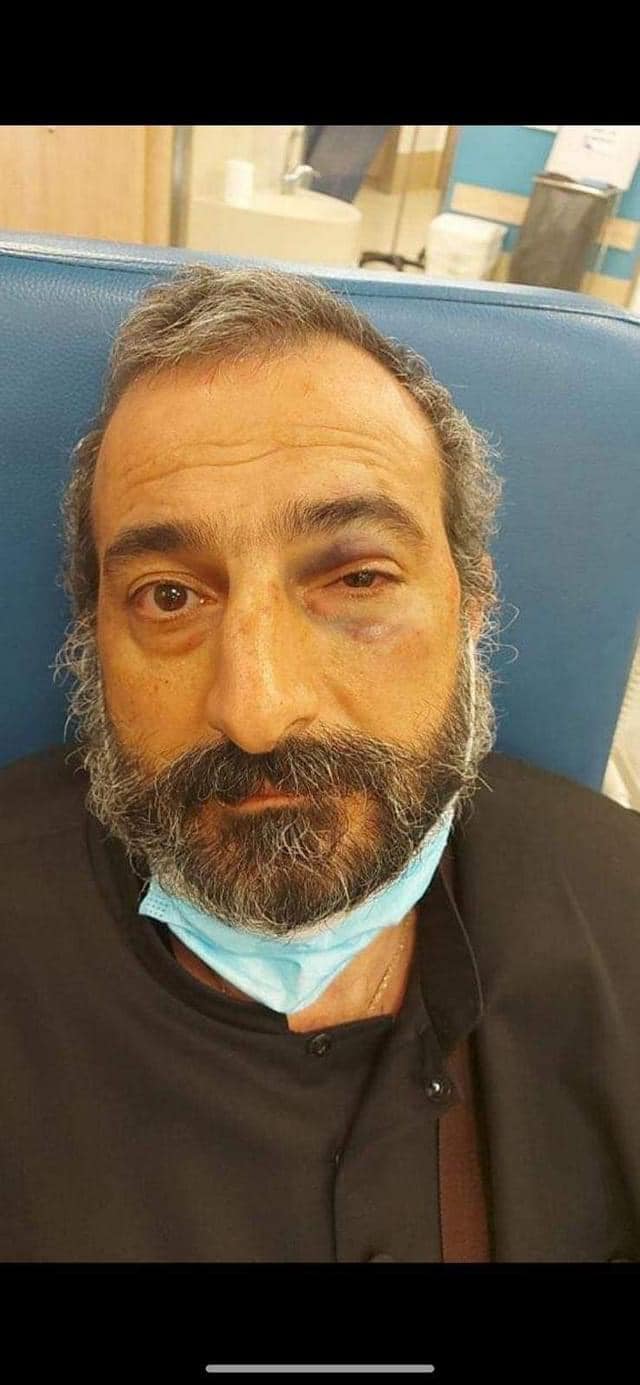 Armenian Patriarchate Jerusalem condemns Jewish settler attack against clergy