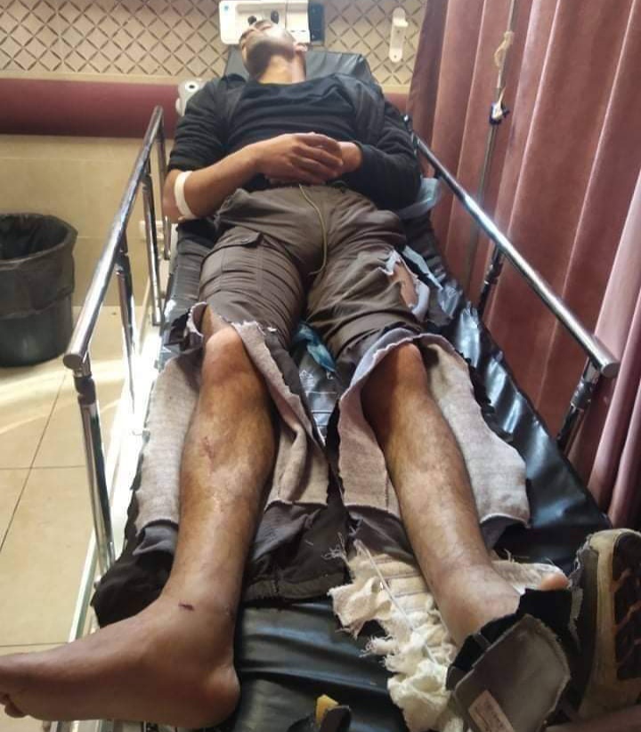 Palestinian man seriously injured by settlers south of Nablus