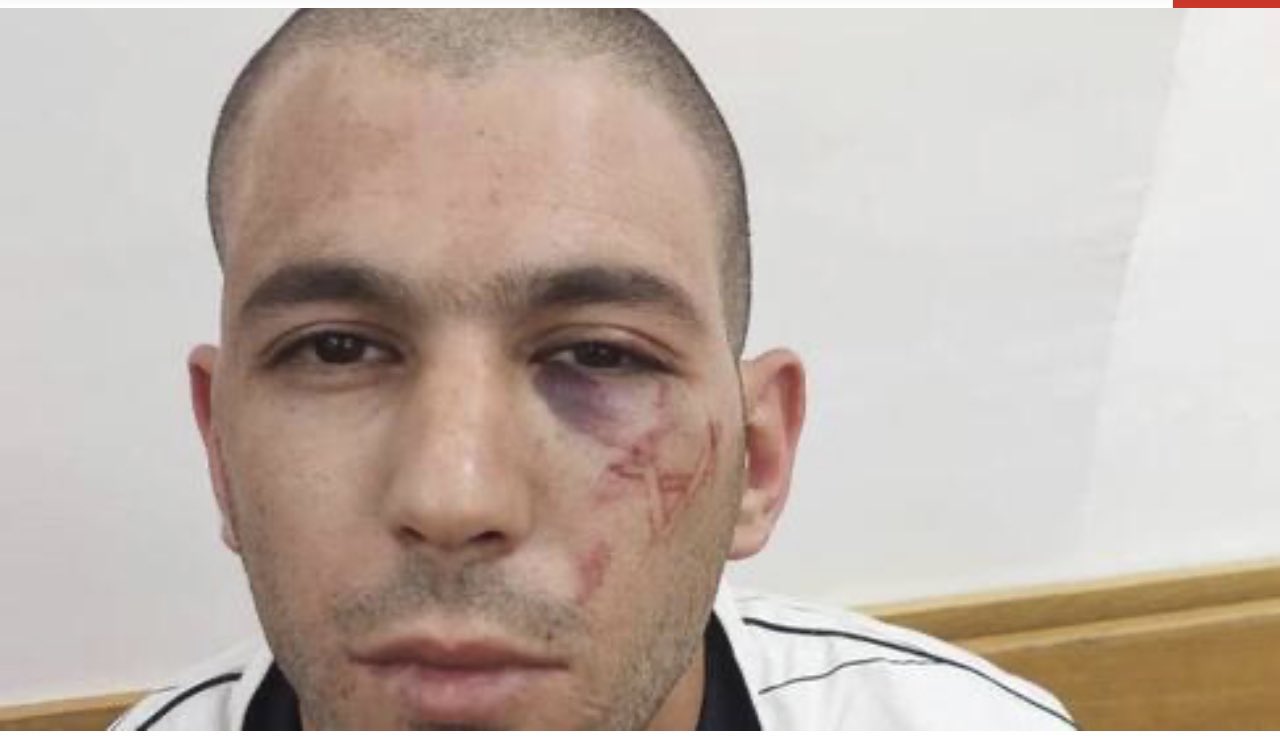 Israeli police assault Palestinian youth, place him under house arrest