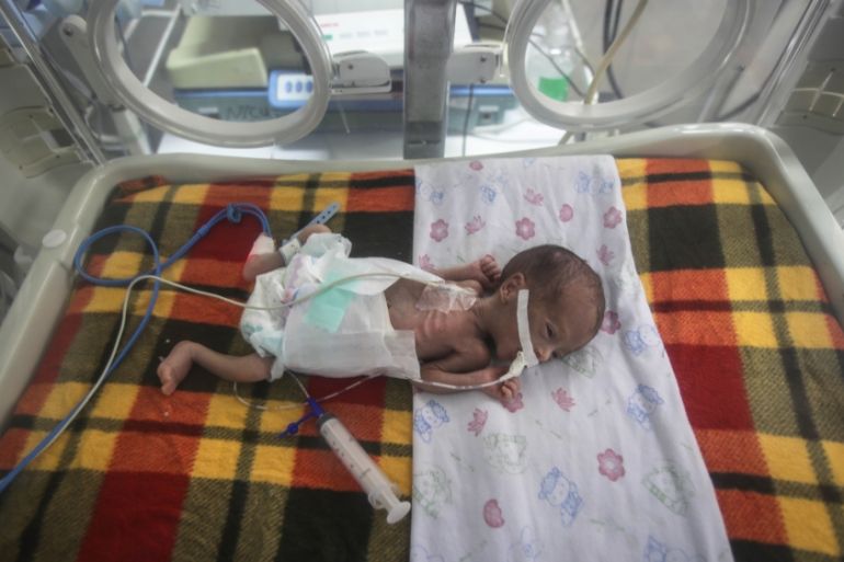 4  infants die from malnutrition at Kamal Adwan Hospital in Gaza