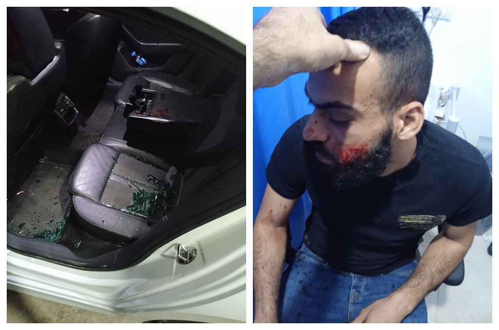 Palestinian driver injured in a stoning attack by Israeli settlers near Ramallah