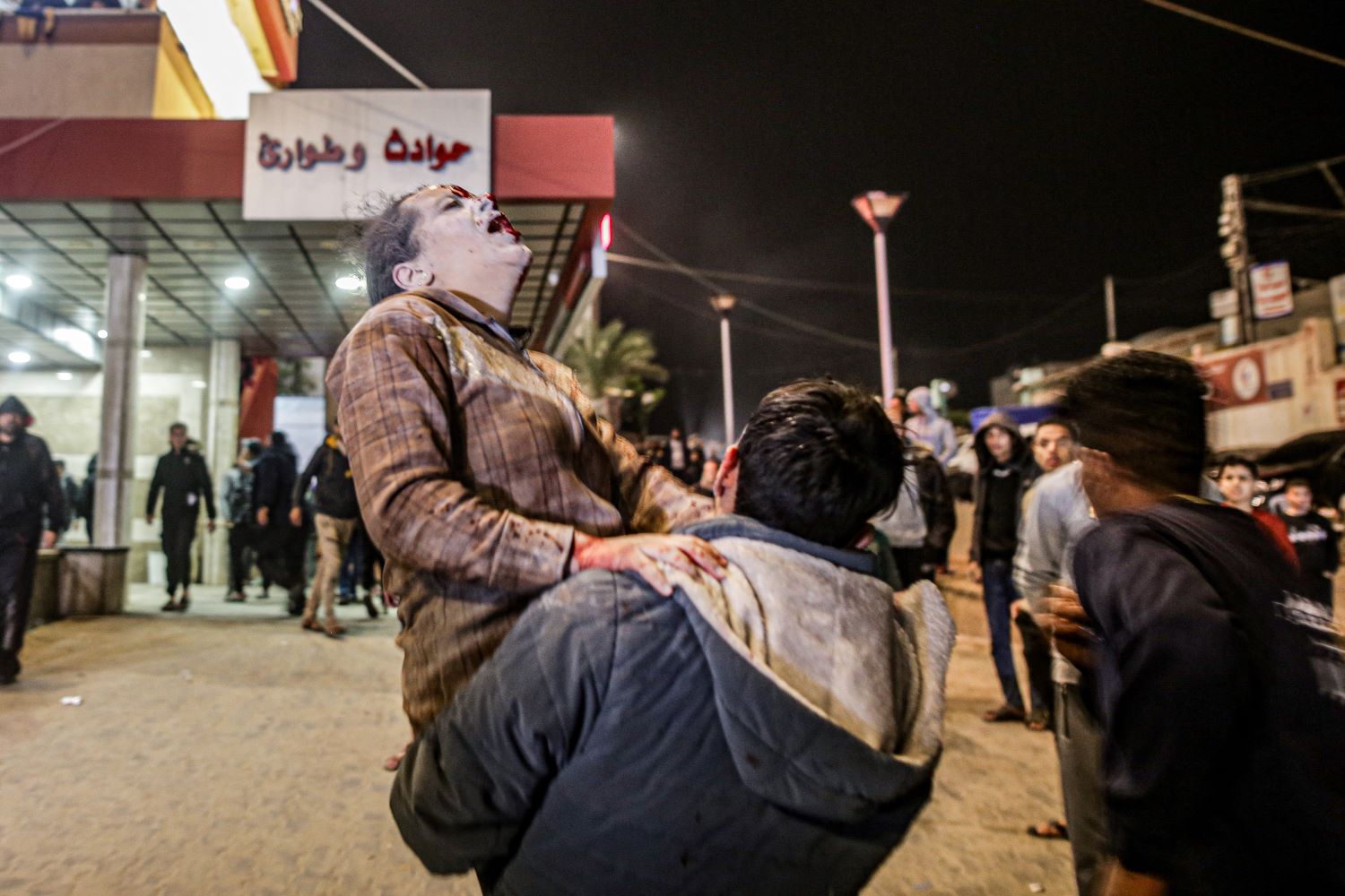 Death toll in Gaza from ongoing Israeli aggression surpasses 35,456