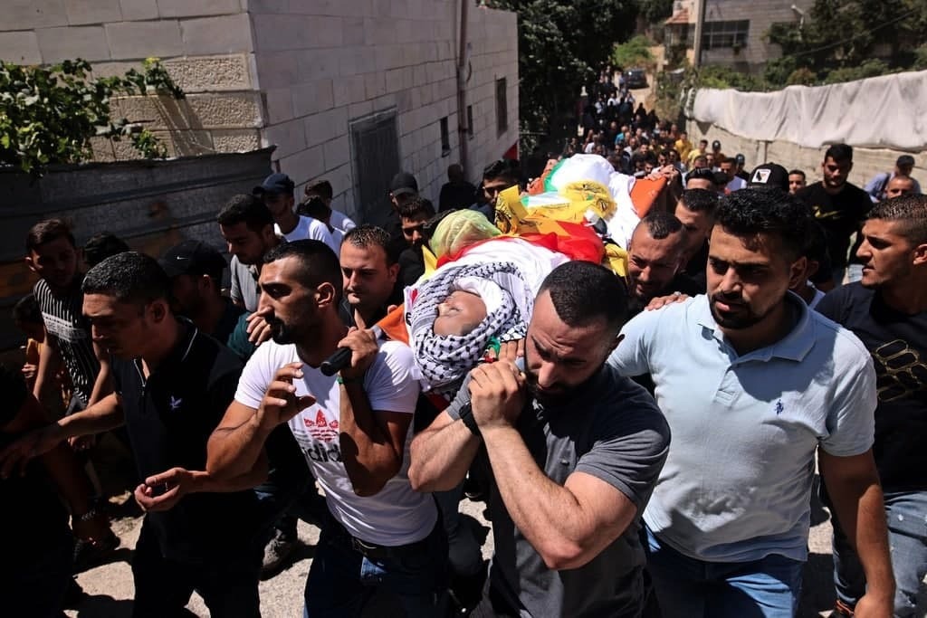 Palestinian shot and critically injured by Israeli soldiers in the south of the West Bank