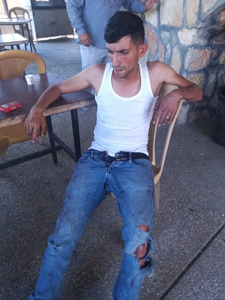 Israeli settlers attack, injure man south of Nablus