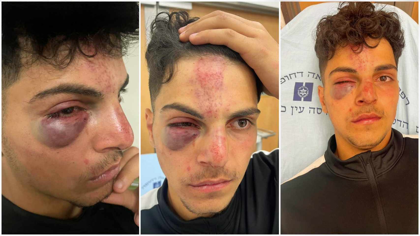 Israeli colonists brutally assault teenager in occupied Jerusalem