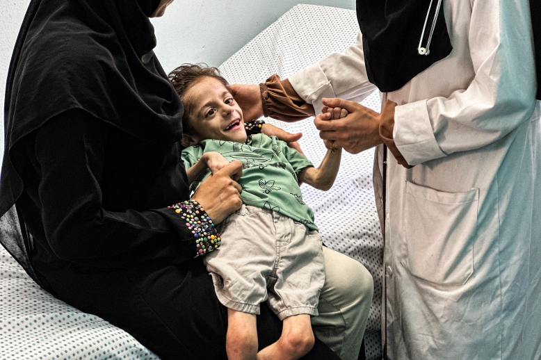 UNICEF announces closure of 21 malnutrition treatment centers in Gaza amid ongoing Israeli attacks