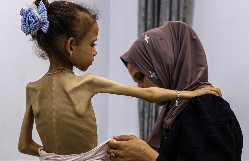 Three Palestinians die from starvation in Gaza as malnutrition death toll rises to 376