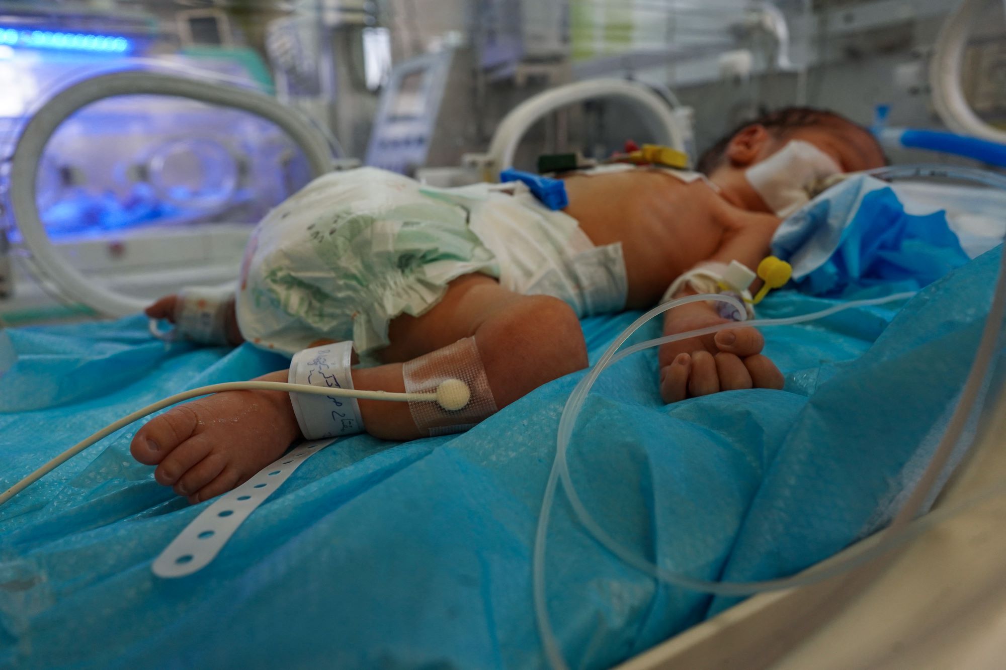 Malnutrition in Gaza poses great danger to pregnant women and newborns, says UNPF