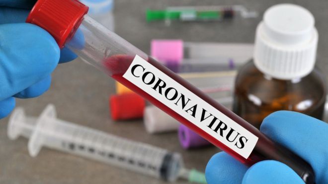 82-year-old Palestinian man dies of coronavirus in the West Bank; corona victim number 70
