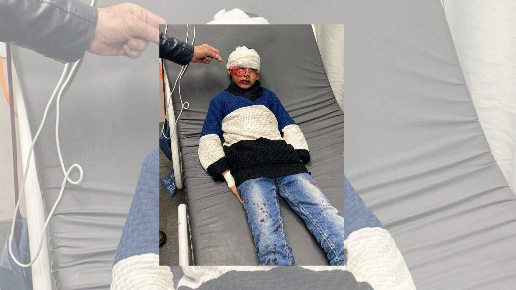 Israeli settlers severely beat up, injure Palestinian child east of Hebron 