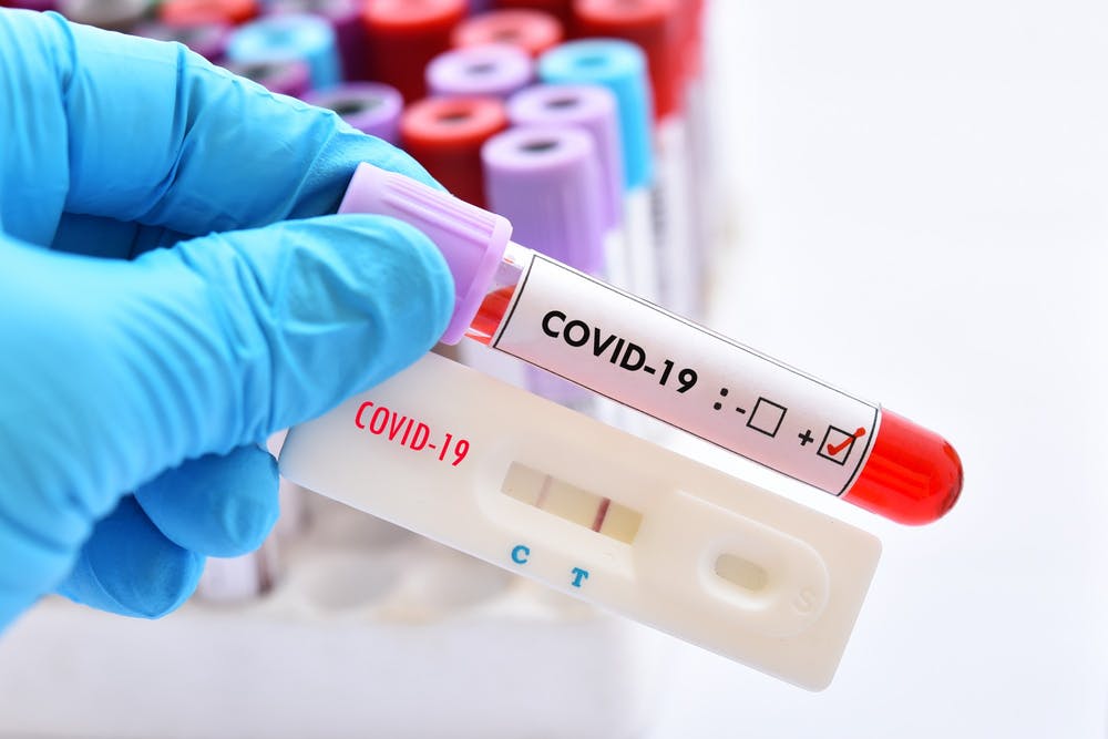 Twelve new cases of coronavirus among Palestinians in diaspora - Health ministry