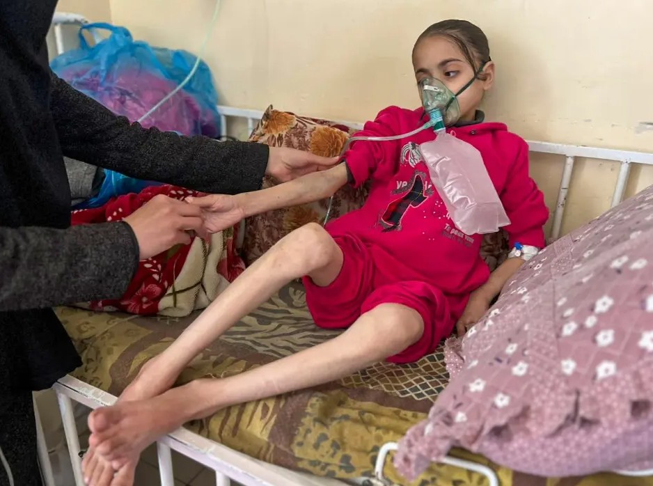 WHO: 112 Palestinian children hospitalized daily in Gaza due to malnutrition