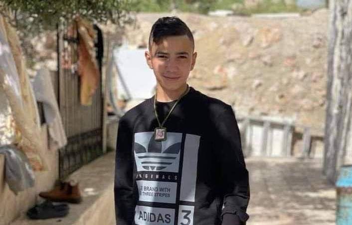Child injured earlier succumbs to his wounds