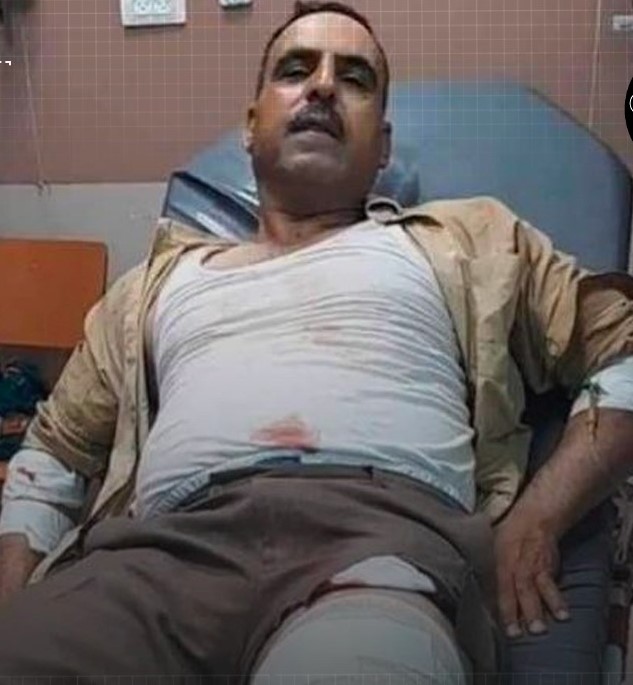 A man wounded by a settler’s bullet in Burqa village and his four sons among 16 Palestinians detained by Israel