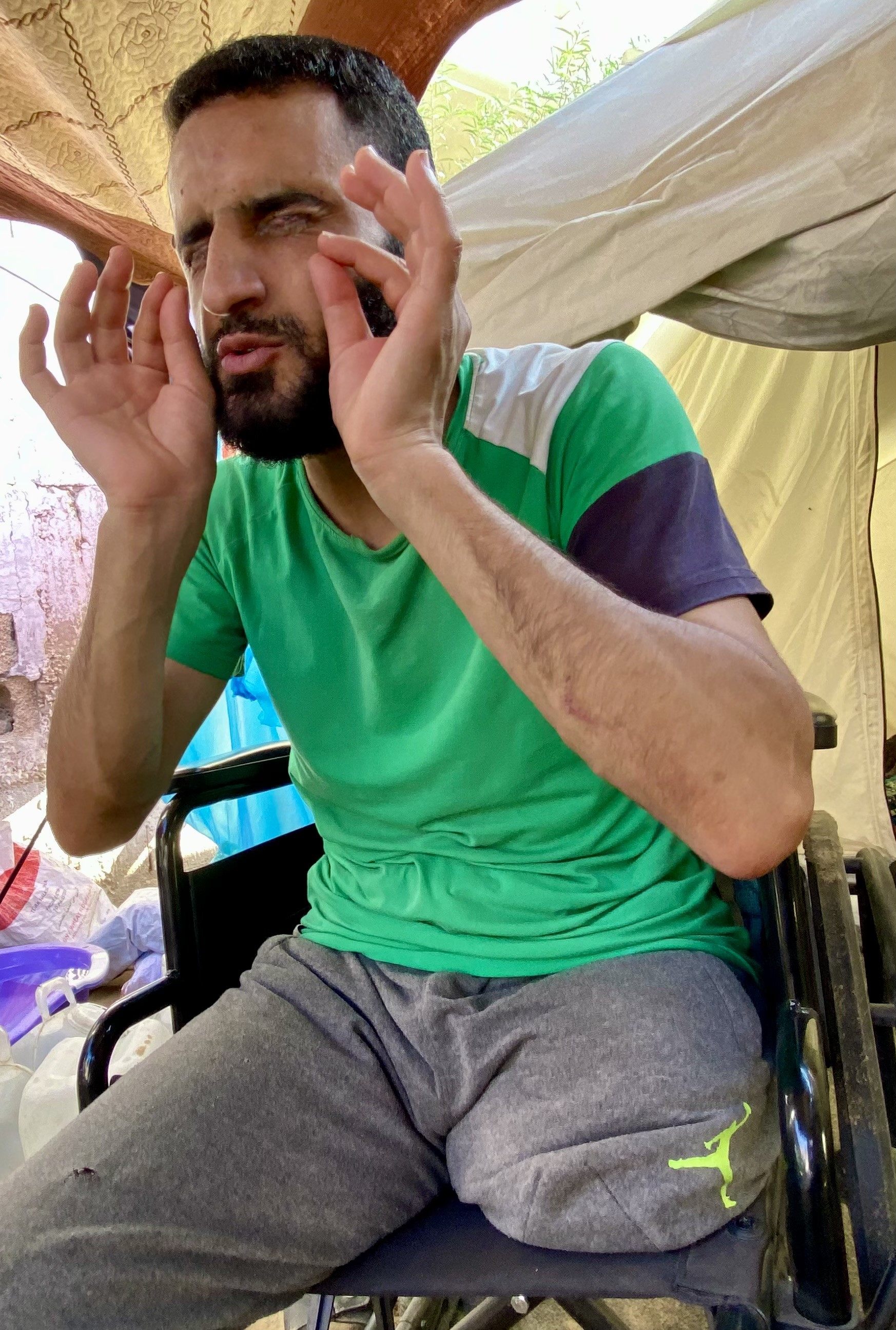 Palestinian former detainee loses sight after torture in Israeli prison