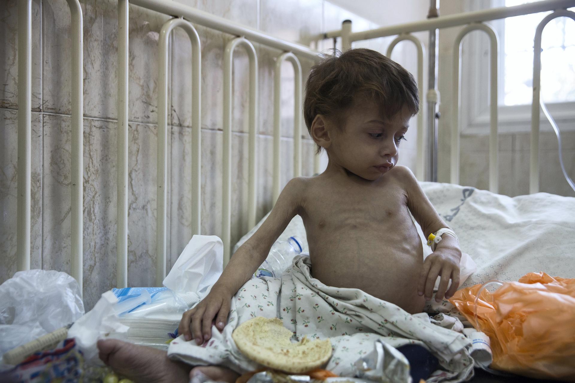 One in three children under 2 in Gaza is experiencing malnutrition: UNRWA