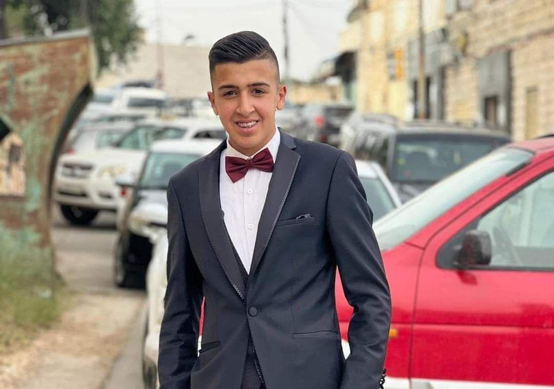 Youth, 17, dies of wounds sustained by an Israeli settler’s bullets a few days ago