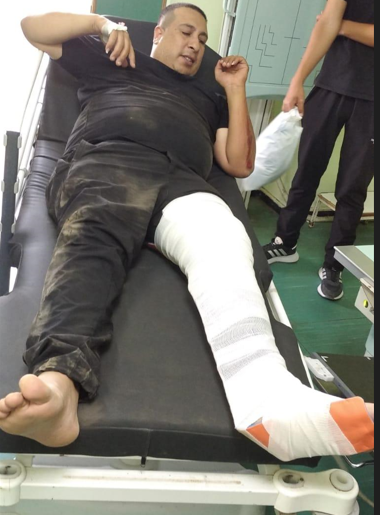 Israeli occupation forces assault Palestinian man near Tulkarm