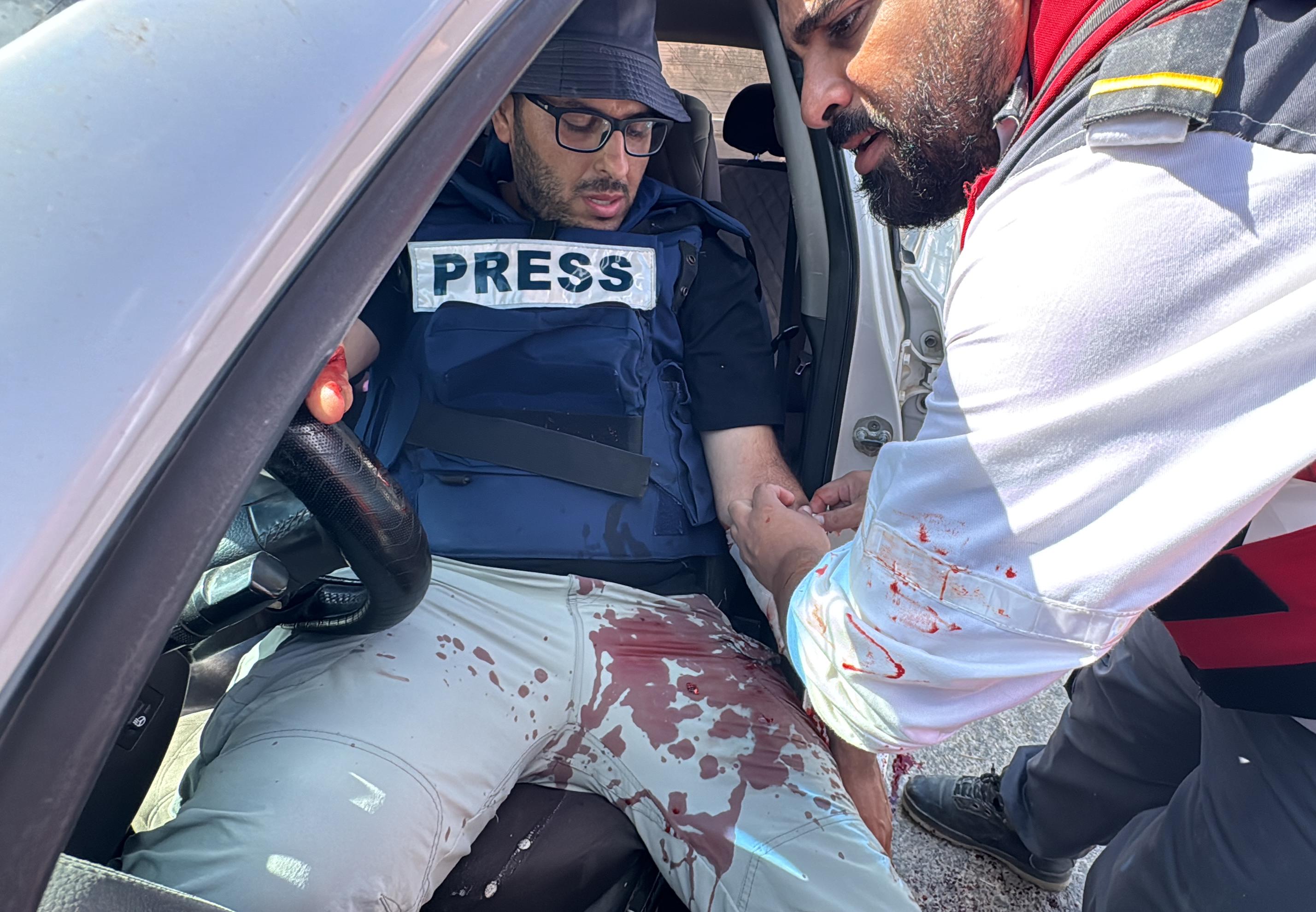 UPDATE: Israeli forces directly target four journalists, including two WAFA photojournalists in Jenin 