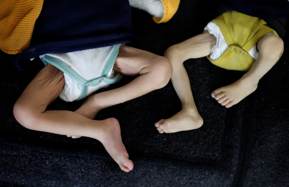 12-year-old child dies of malnutrition and dehydration amid Israeli siege in Gaza