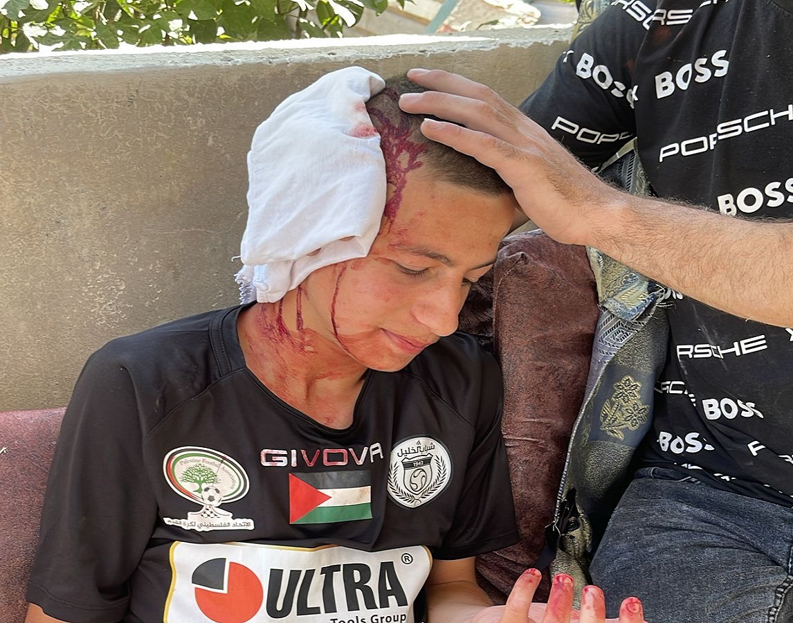 Two Palestinians sustain injuries from Israeli army gunfire in Hebron