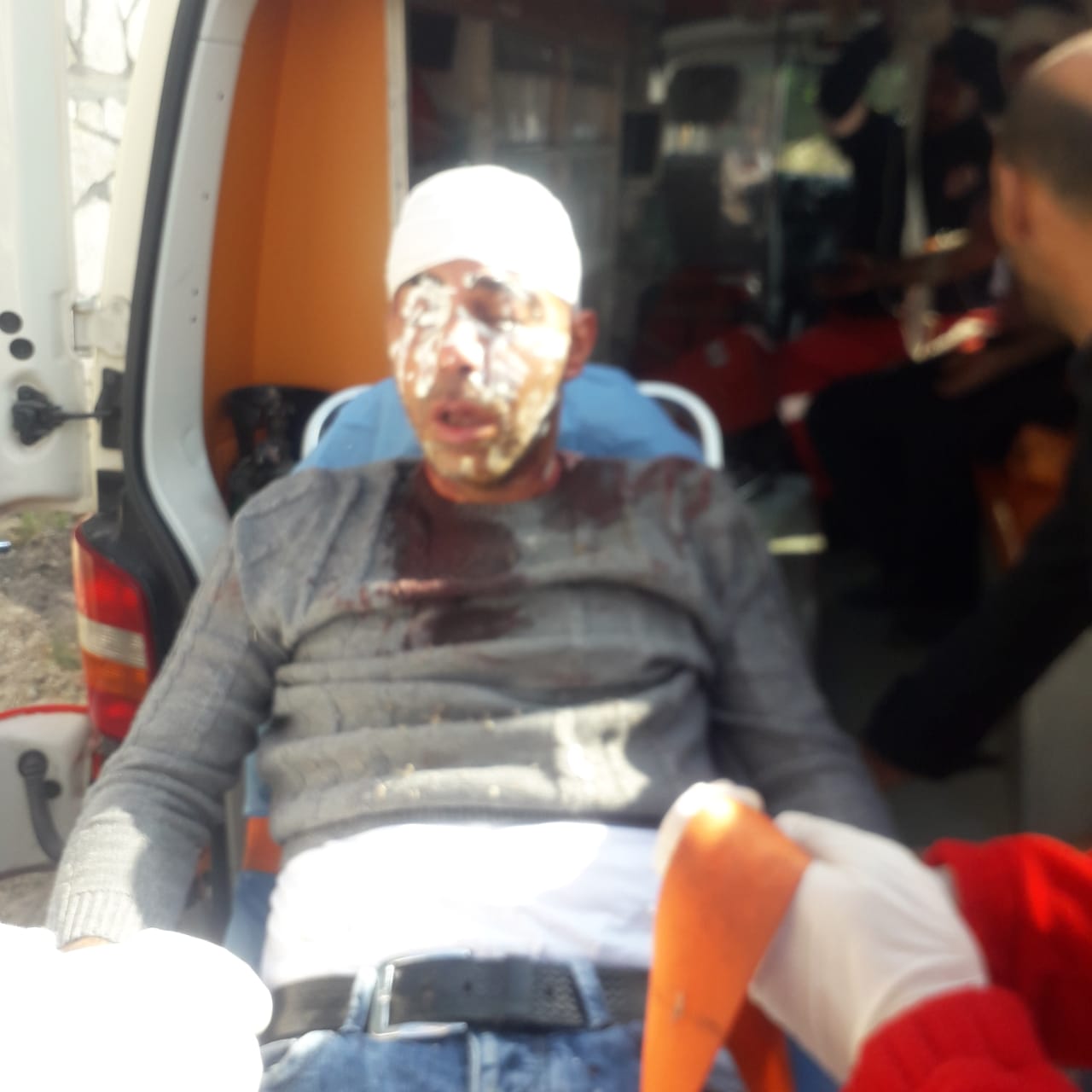 Israeli settlers attack Palestinians near Nablus with stones, injuries reported 