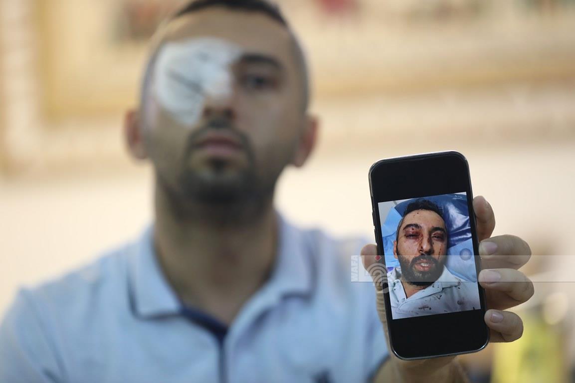 ‘The last thing I saw when I had two eyes’