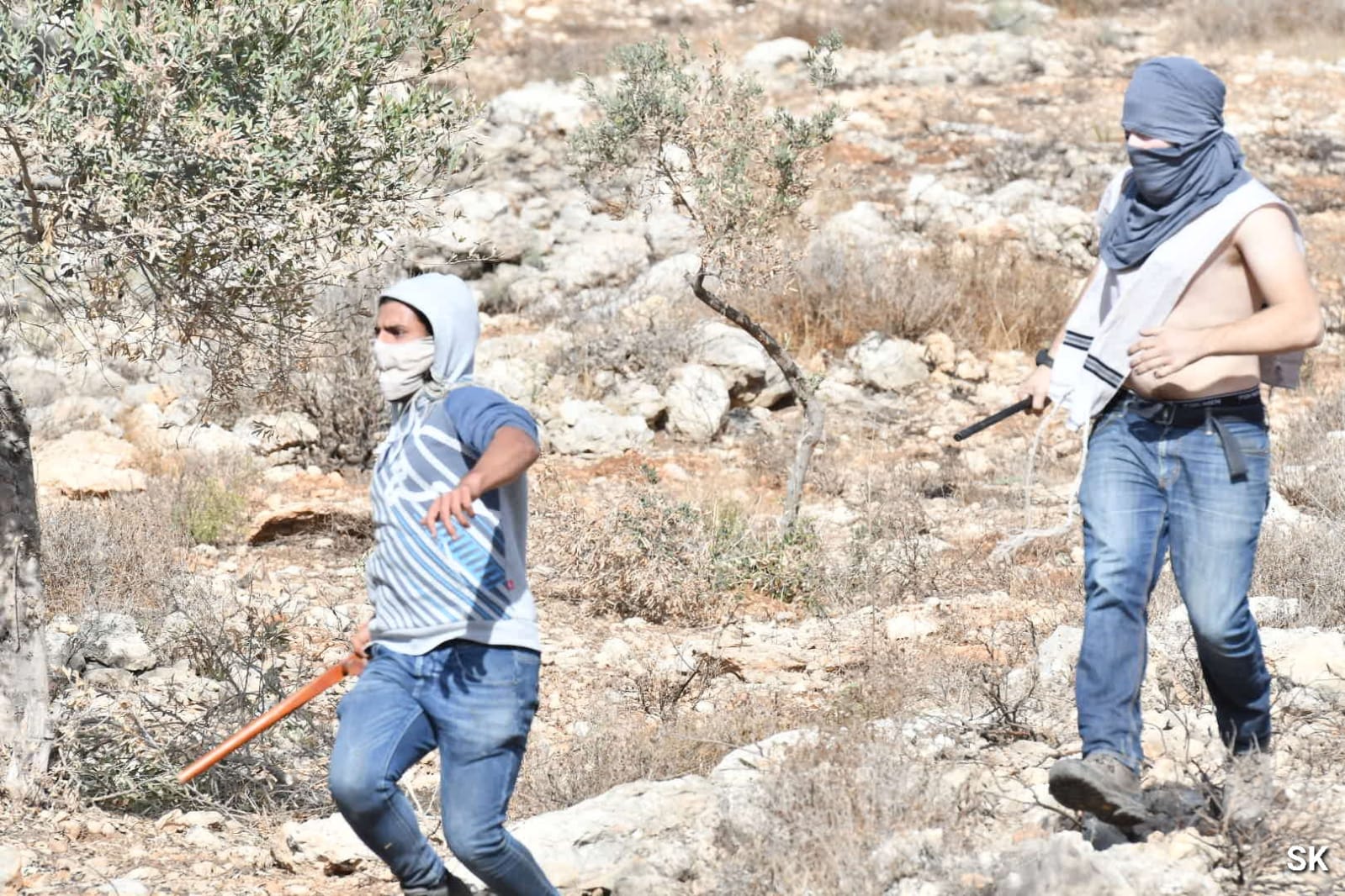 Palestinian youth injured in a terror attack by Israeli colonists northeast of Jerusalem