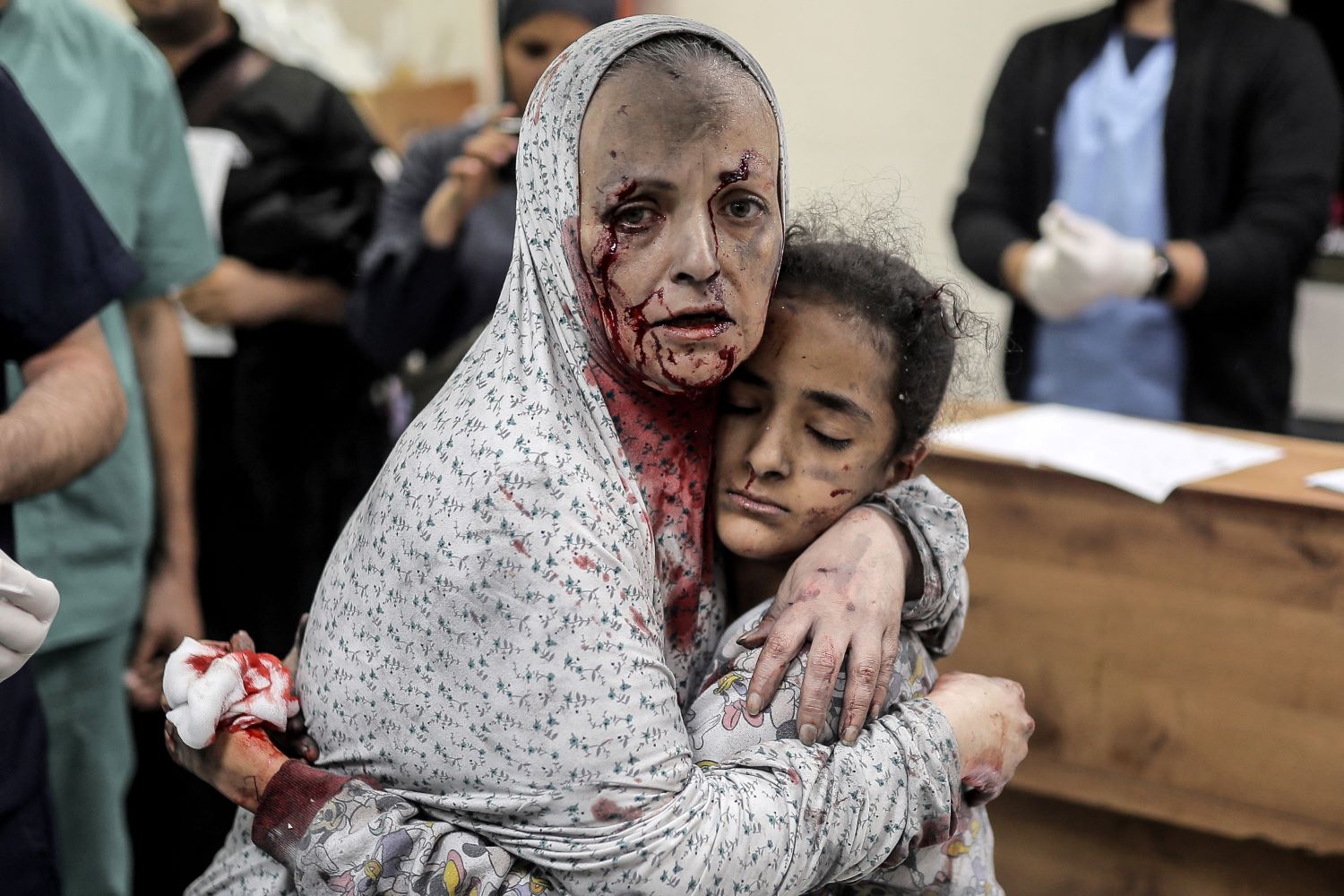 Day 253, scores of civilians killed and others injured in Israeli bombardment on Gaza