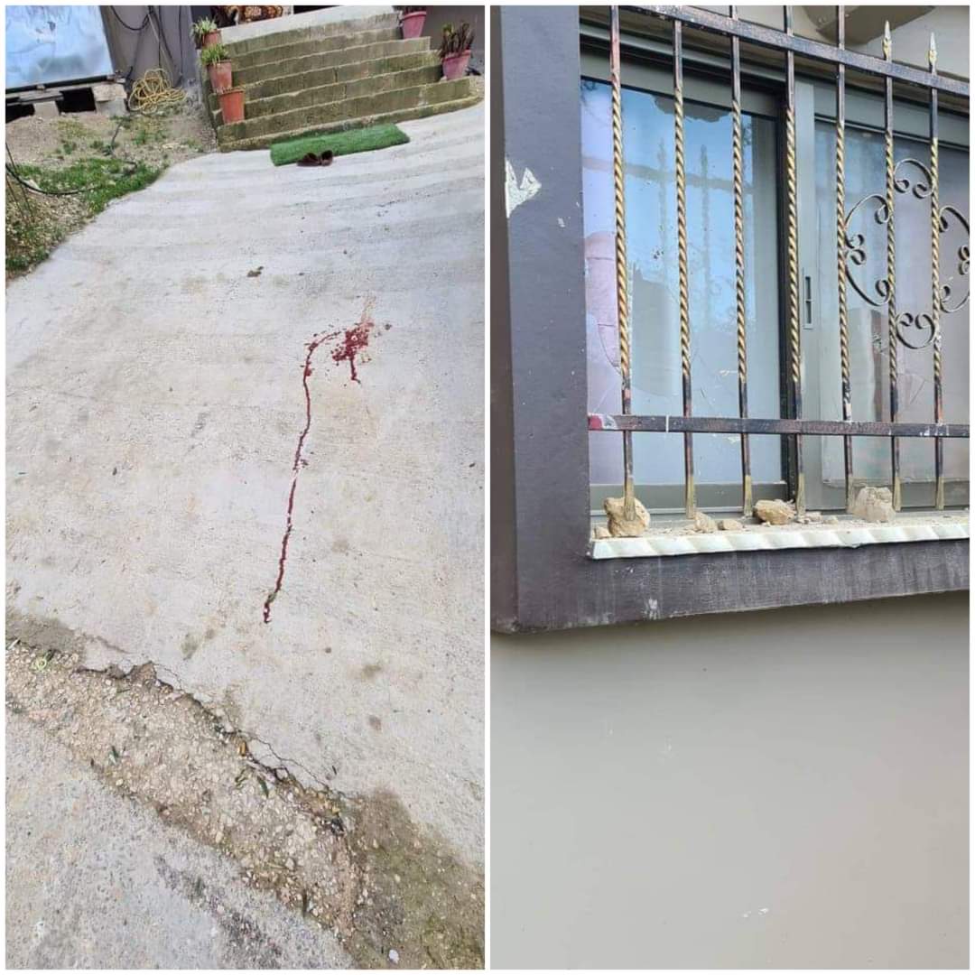 Girl injured as she survives kidnapping attempt by settlers near Nablus