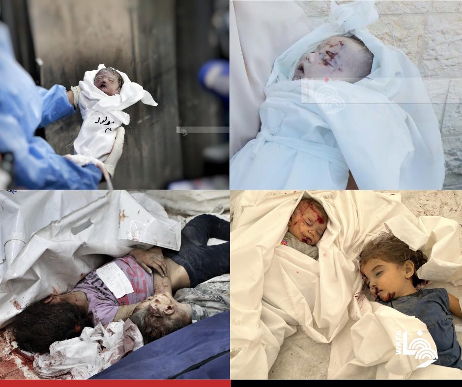 Death toll in Gaza today reaches 379, overall death toll after 16 days of ongoing Israeli aggression surges to 4651 – Health Ministry