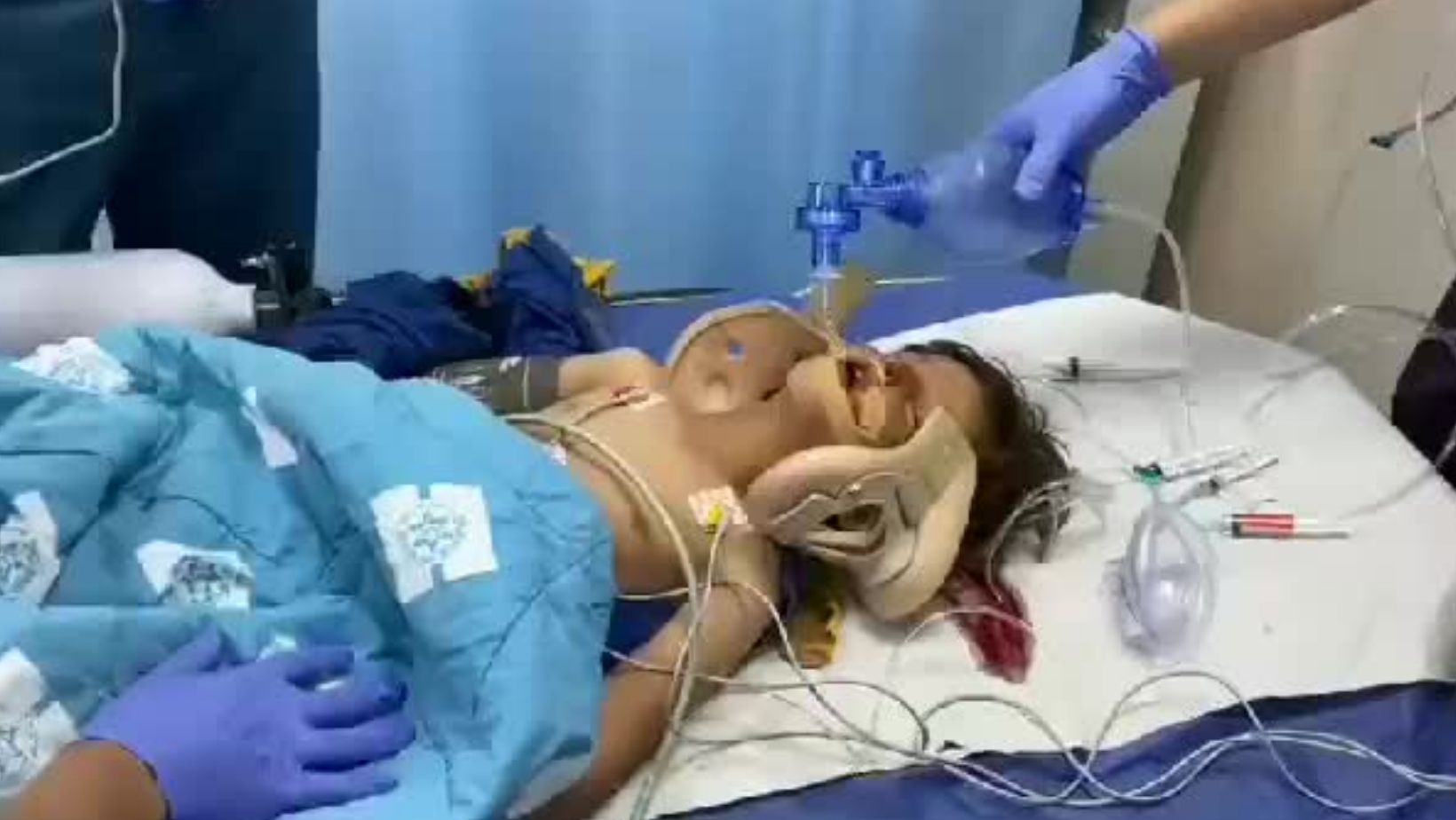 Palestinian child, 4, in critical condition after Israeli settler run him over near Bethlehem