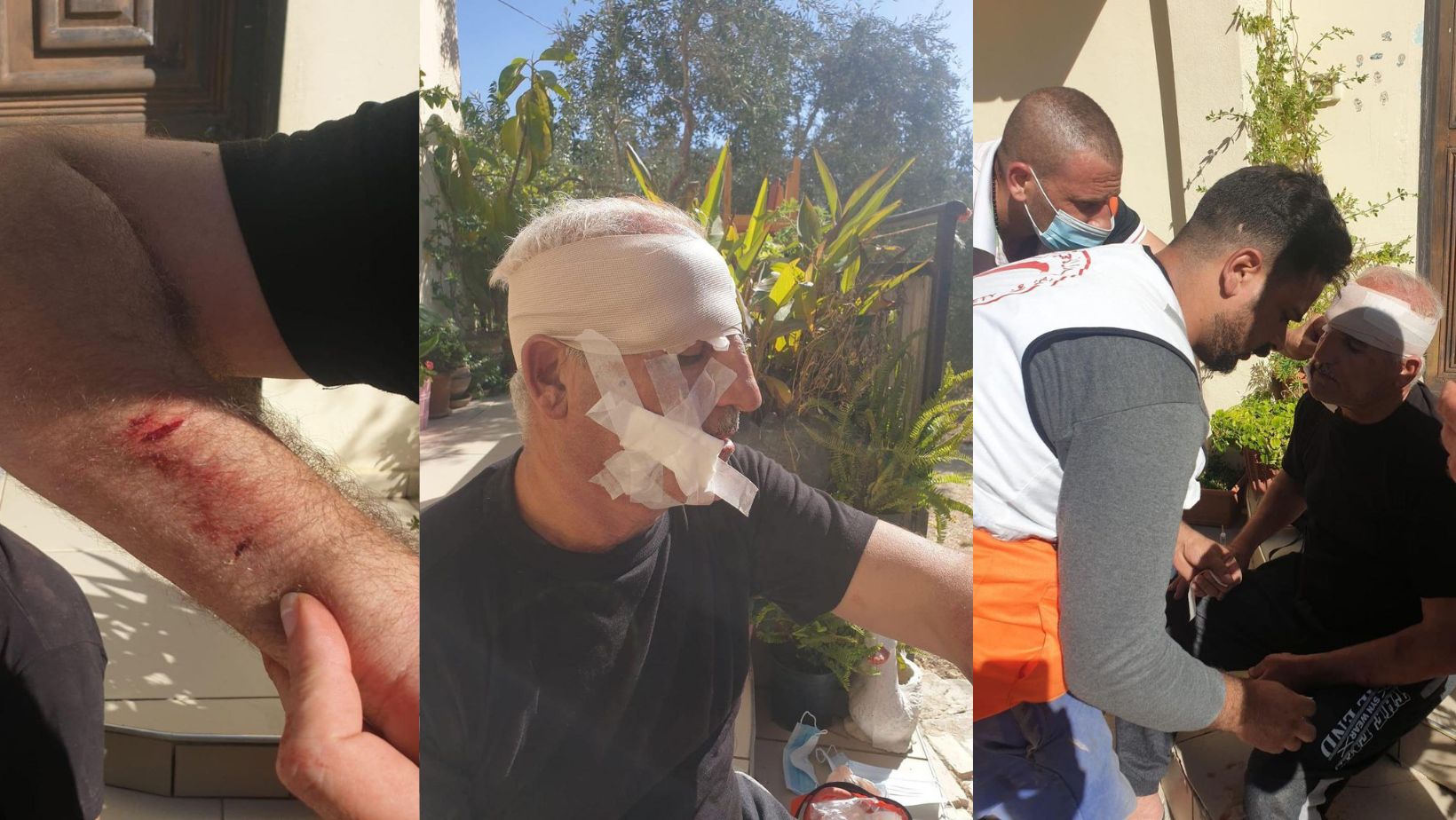 21 Palestinians injured in Israeli settlers' attack on Nablus-area village