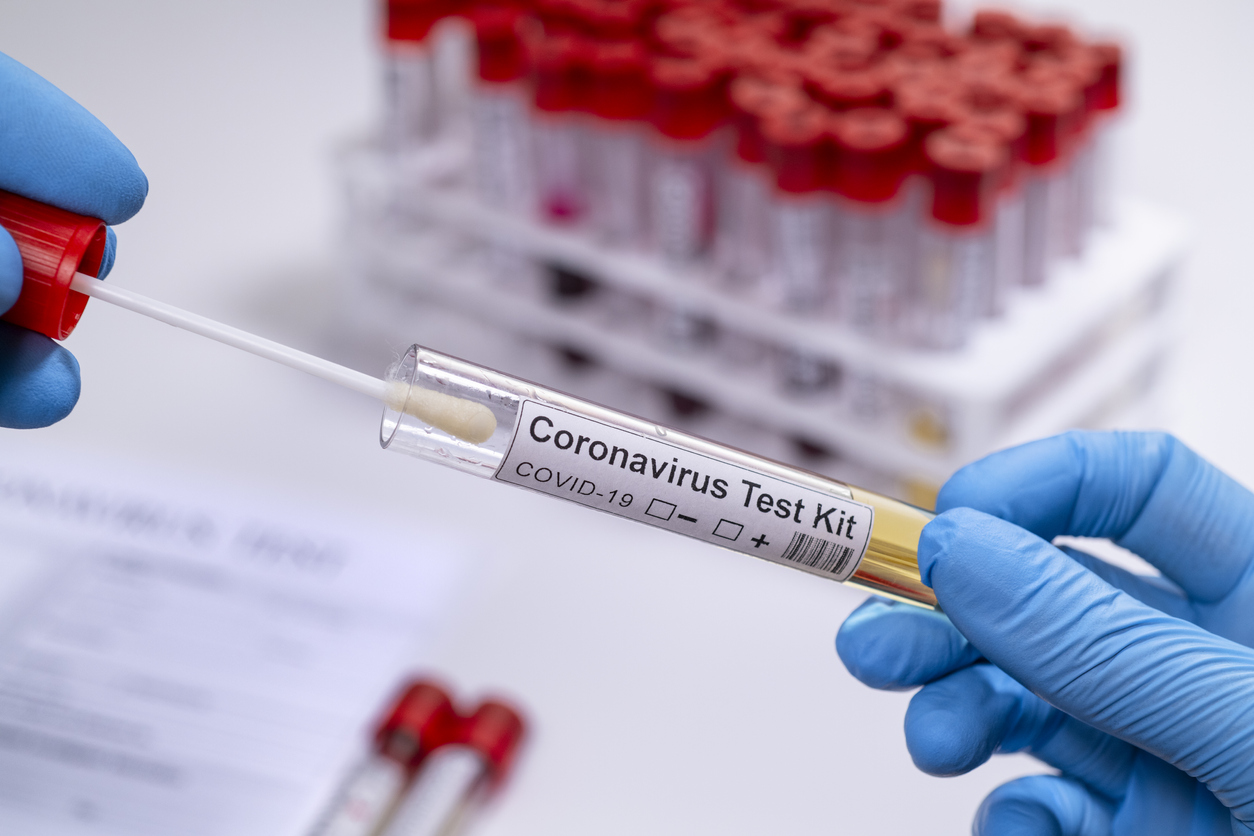 Seven deaths, 976 new cases and 585 recoveries from coronavirus in Palestine – Health Minister