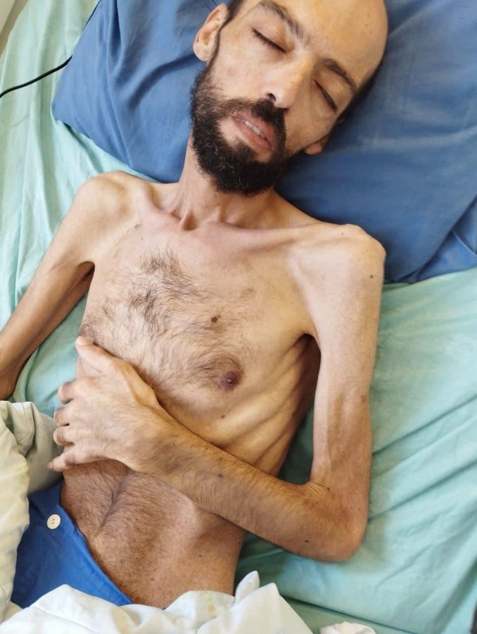 After six months of hunger strike, administrative detainee Awawda says he is left with bone and skin only