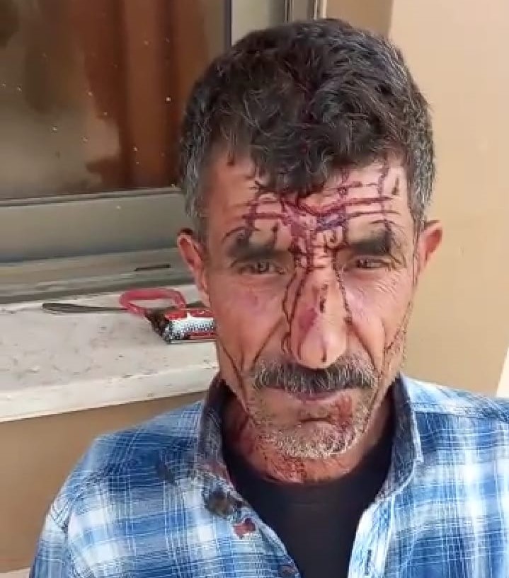 Israeli settlers attack, injure Palestinian shepherd near Jenin 
