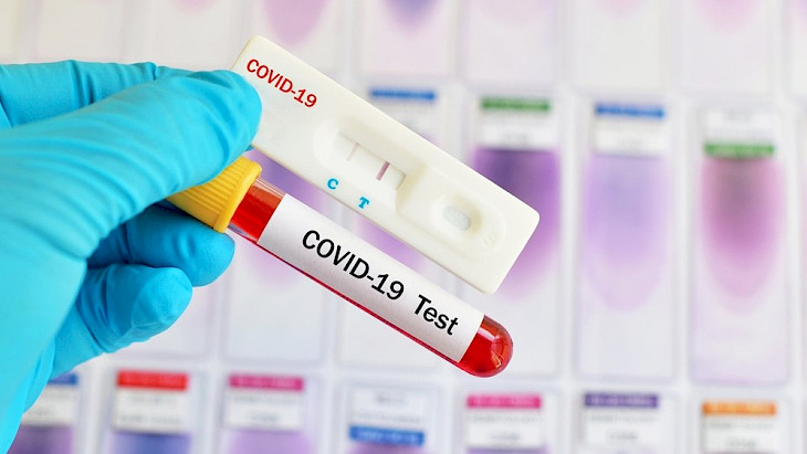 Daily coronavirus report: 397 new cases, one death, 442 recoveries 