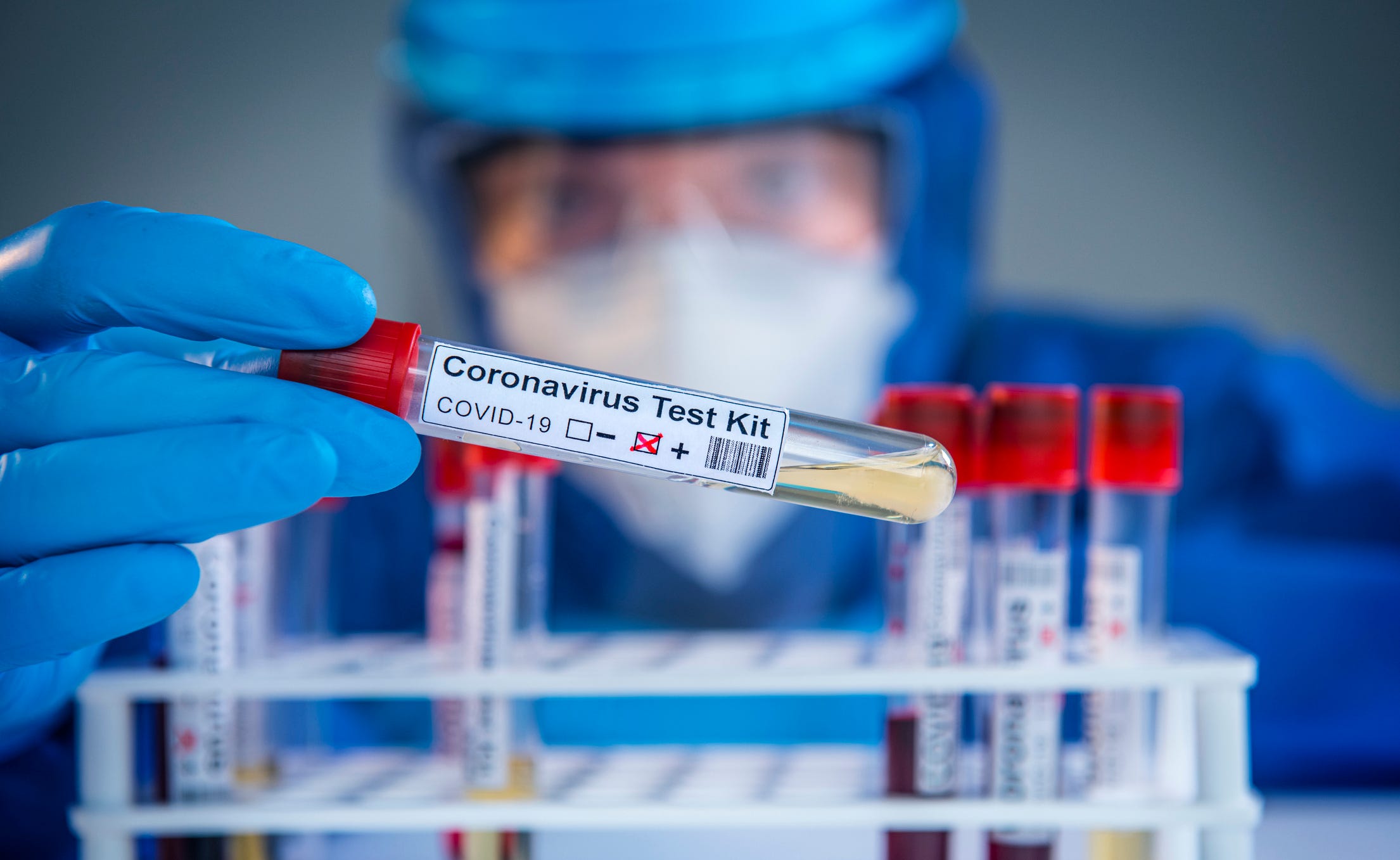 Palestine maintains steady decline in daily COVID-19 infections, with 20 deaths 