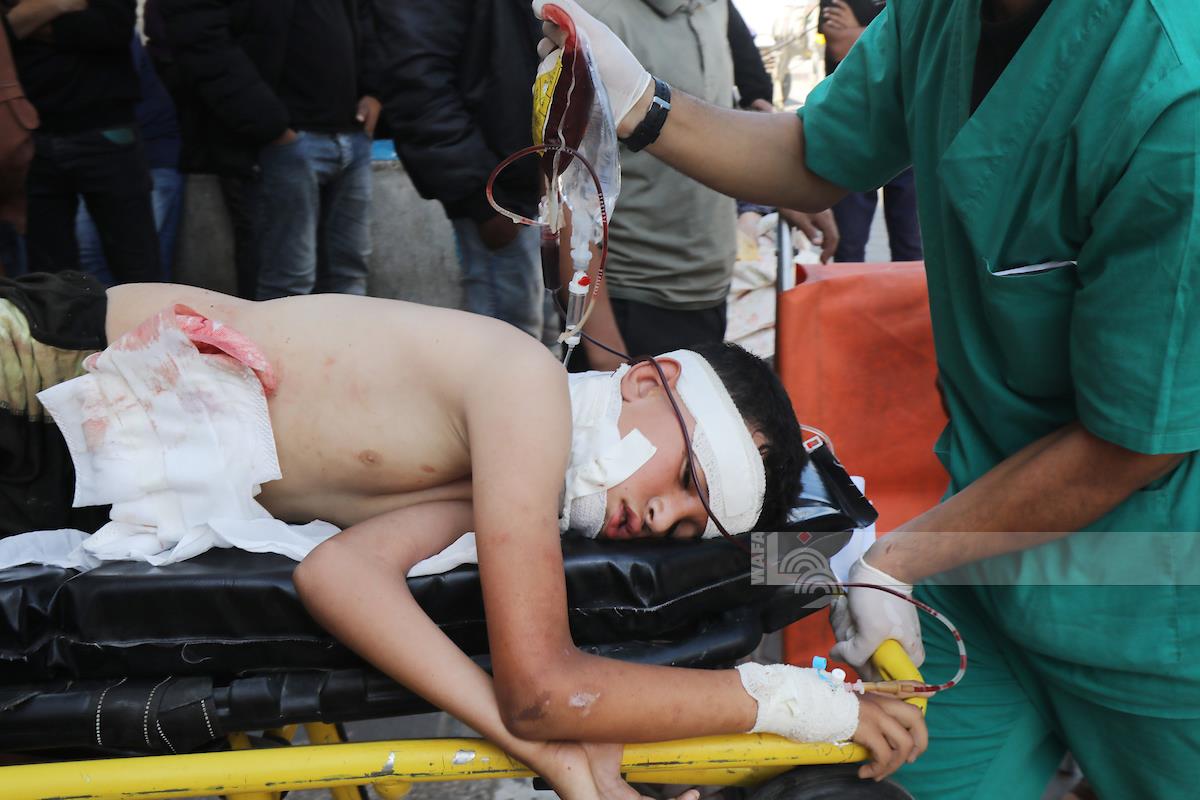 Several casualties reported in Israeli airstrikes on different areas in Gaza 